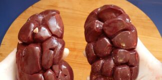 Czy nerka to obciach? Czy nerka to obciach?